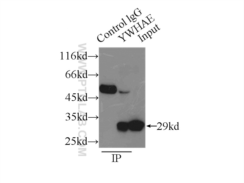 11648-2-AP;A375 cells