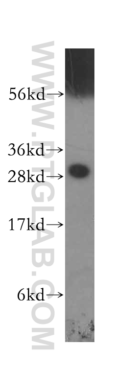 11648-2-AP;A375 cells