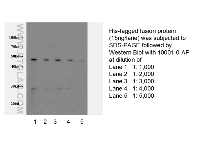 6*his,His tag Antibody 100010AP Proteintech
