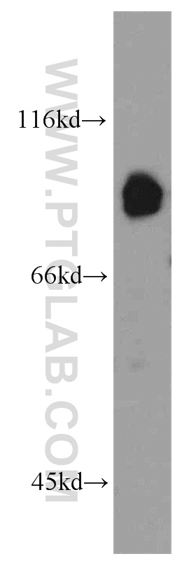 11158-1-AP;mouse liver tissue