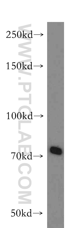 11066-1-AP;mouse thymus tissue