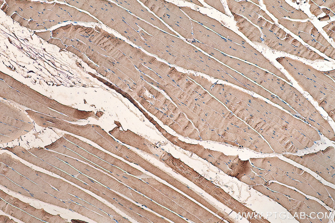 acc1-antibody-21923-1-ap-proteintech