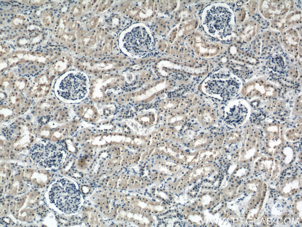 acc1-antibody-21923-1-ap-proteintech