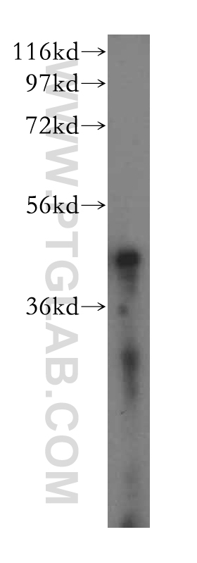 16215-1-AP;human skeletal muscle tissue