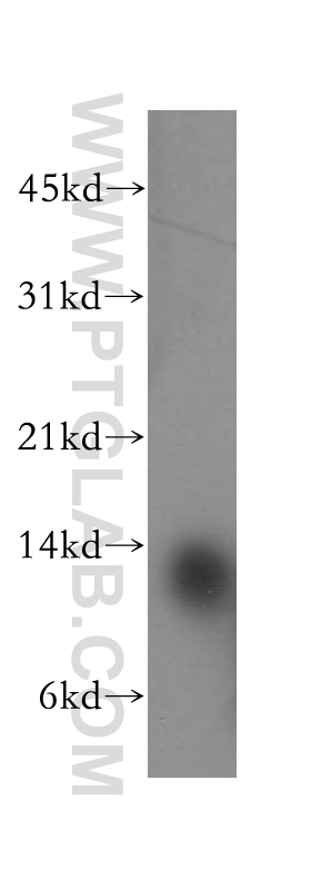 13433-1-AP;human brain tissue