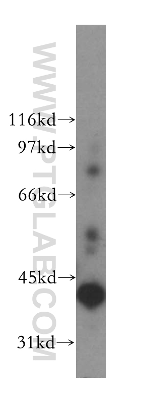 13288-2-AP;human liver tissue