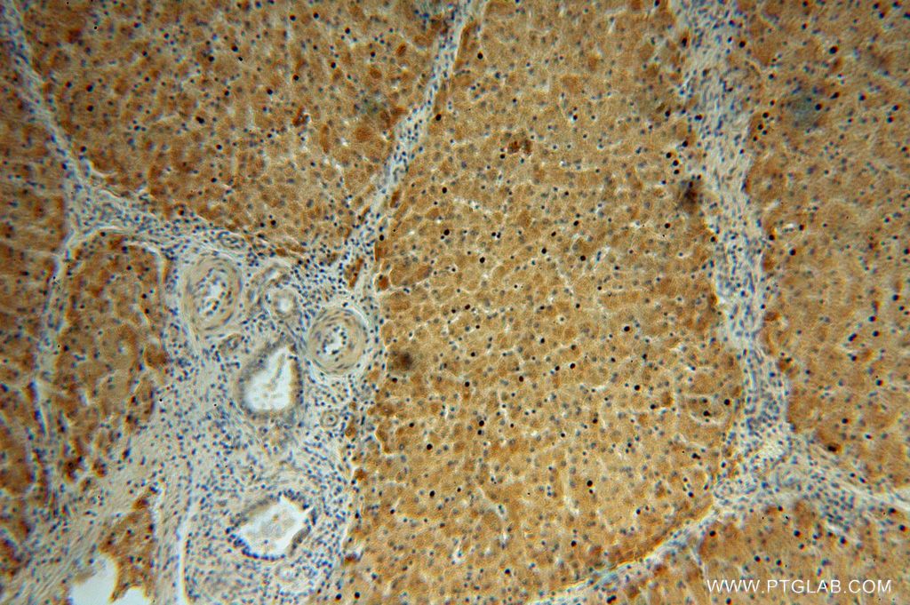 14674-1-AP;H-liver