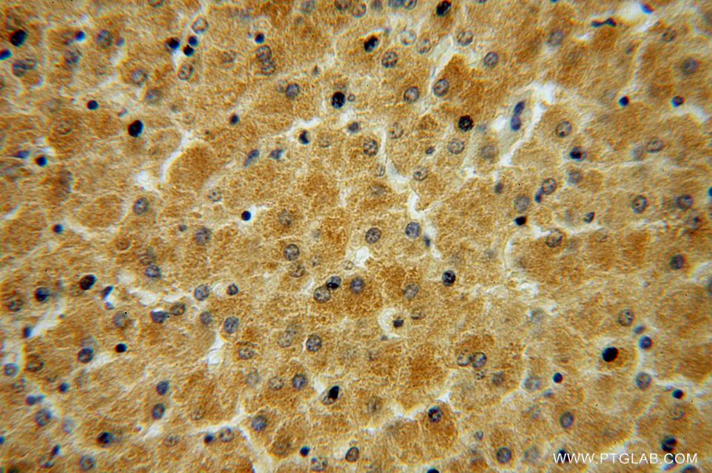 14674-1-AP;H-liver