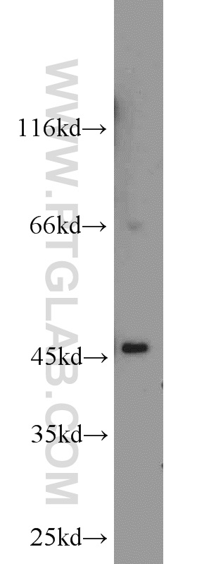 14674-1-AP;rat kidney tissue