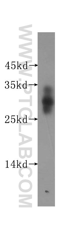 16479-1-AP;human brain tissue