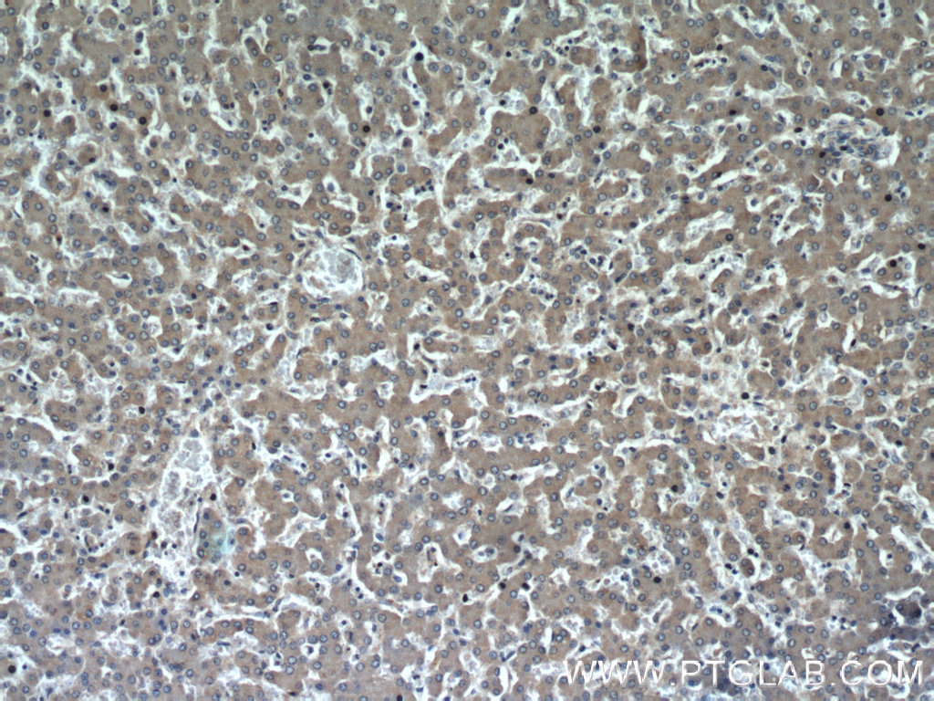 15294-1-AP;human liver tissue