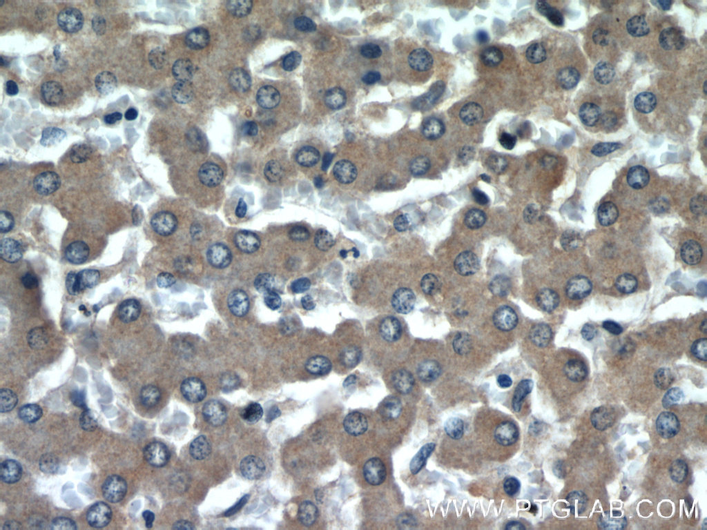 15294-1-AP;human liver tissue