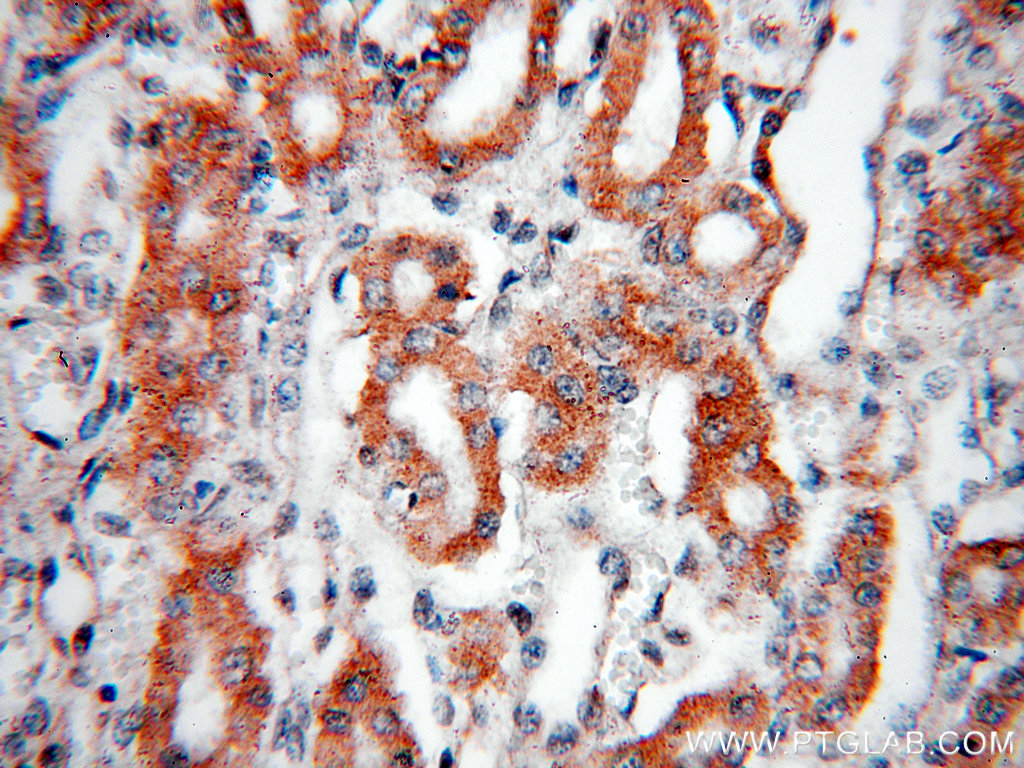 14631-1-AP;H-kidney