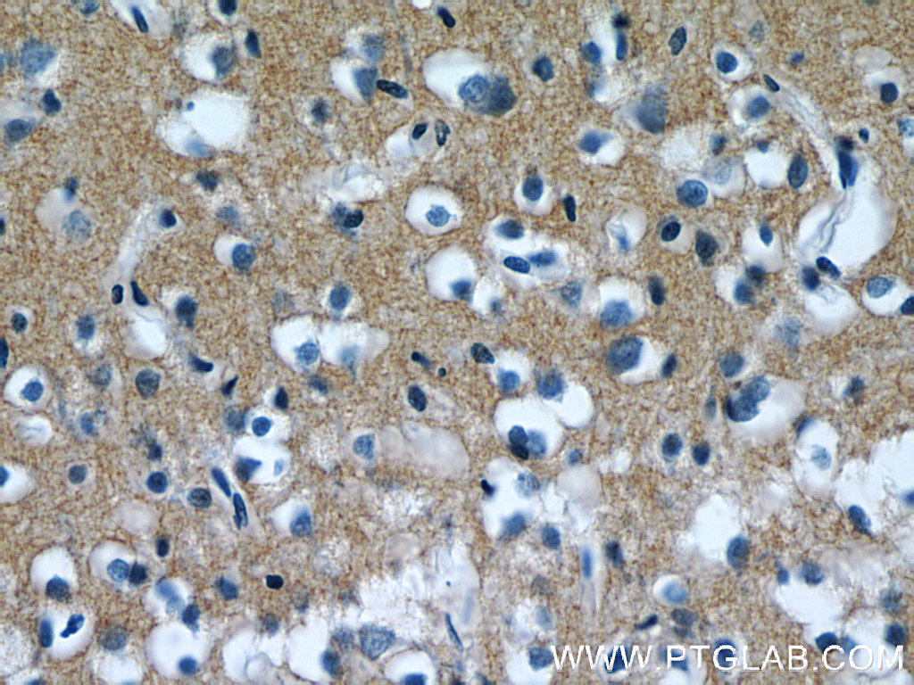 12591-1-AP;human brain tissue