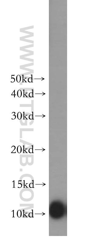 12591-1-AP;human brain tissue