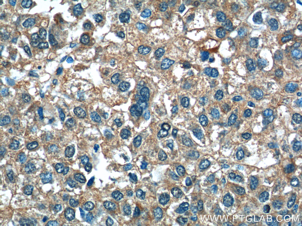 25167-1-AP;human liver cancer tissue