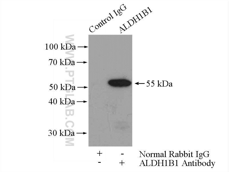 15560-1-AP;mouse brain tissue