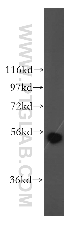 15560-1-AP;HepG2 cells
