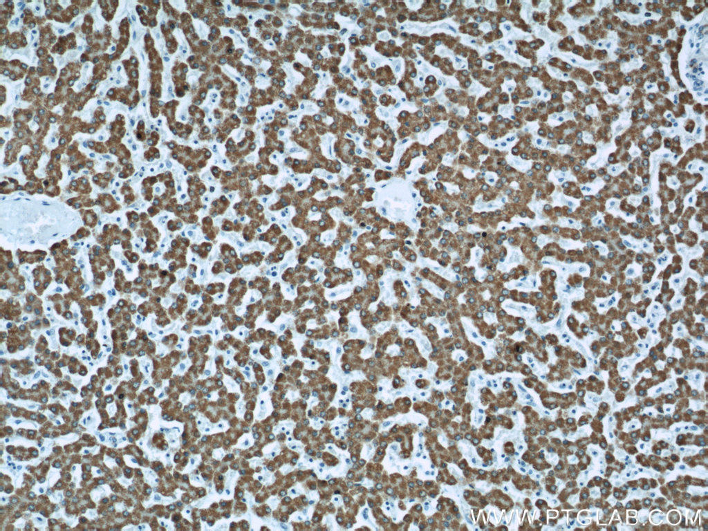 11604-1-AP;human liver