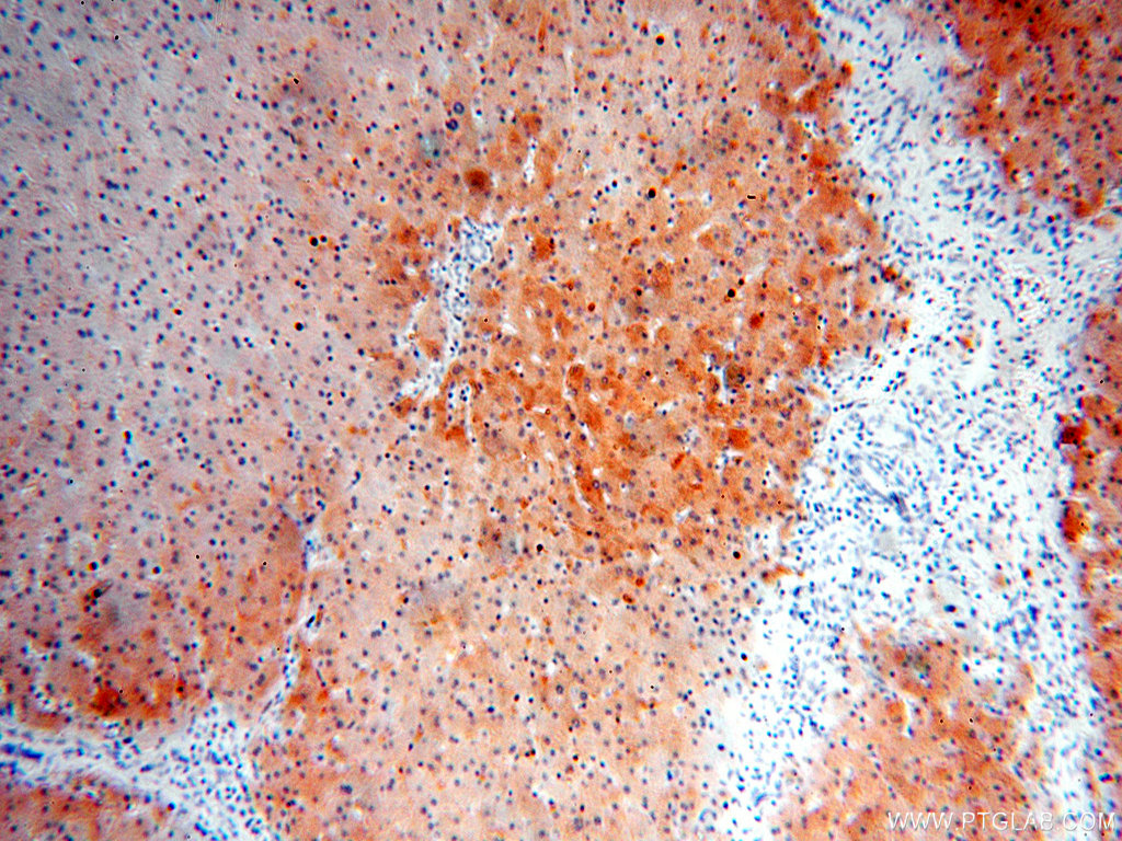 18065-1-AP;human liver