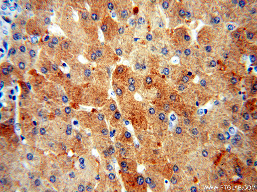 18065-1-AP;human liver