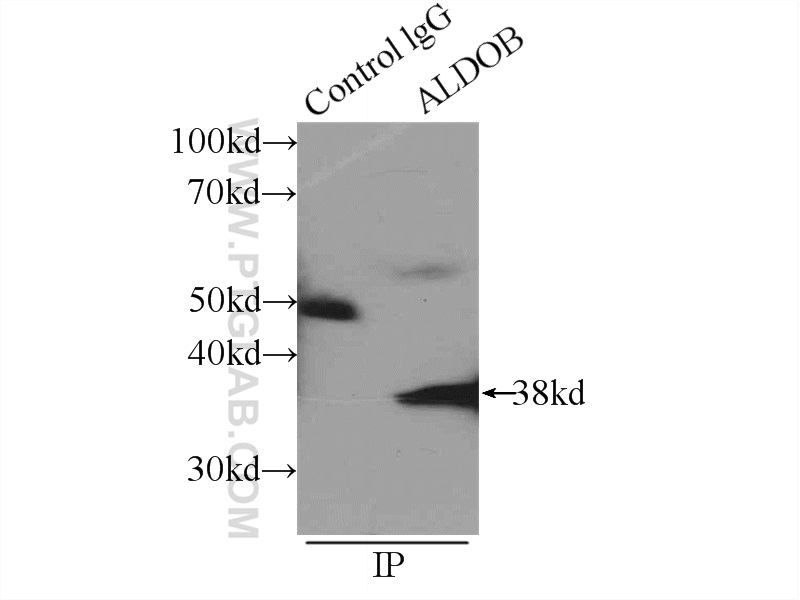 18065-1-AP;mouse kidney tissue