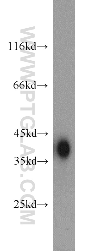 18065-1-AP;mouse kidney tissue