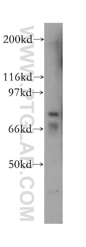 13073-1-AP;MCF7 cell