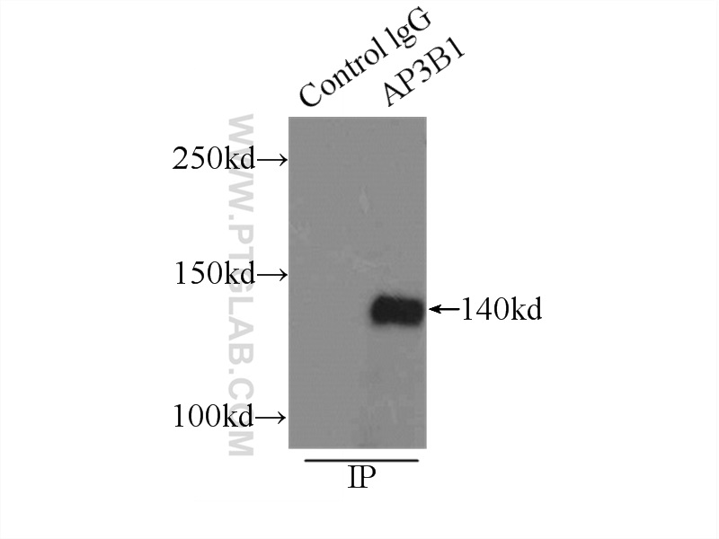 13384-1-AP;COLO 320 cells