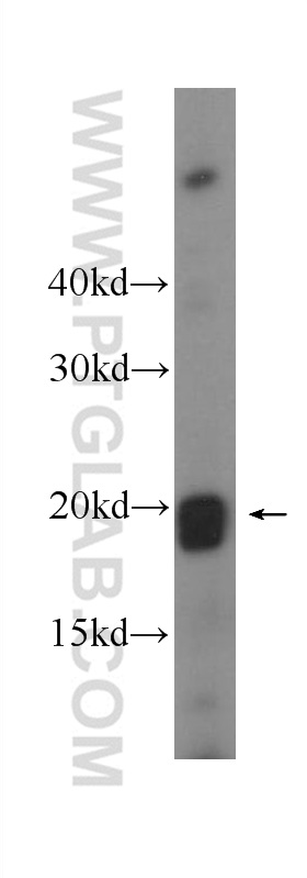 10591-1-AP;Human peripheral blood leukocyte cells