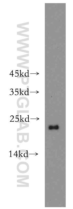10790-1-AP;HeLa cells