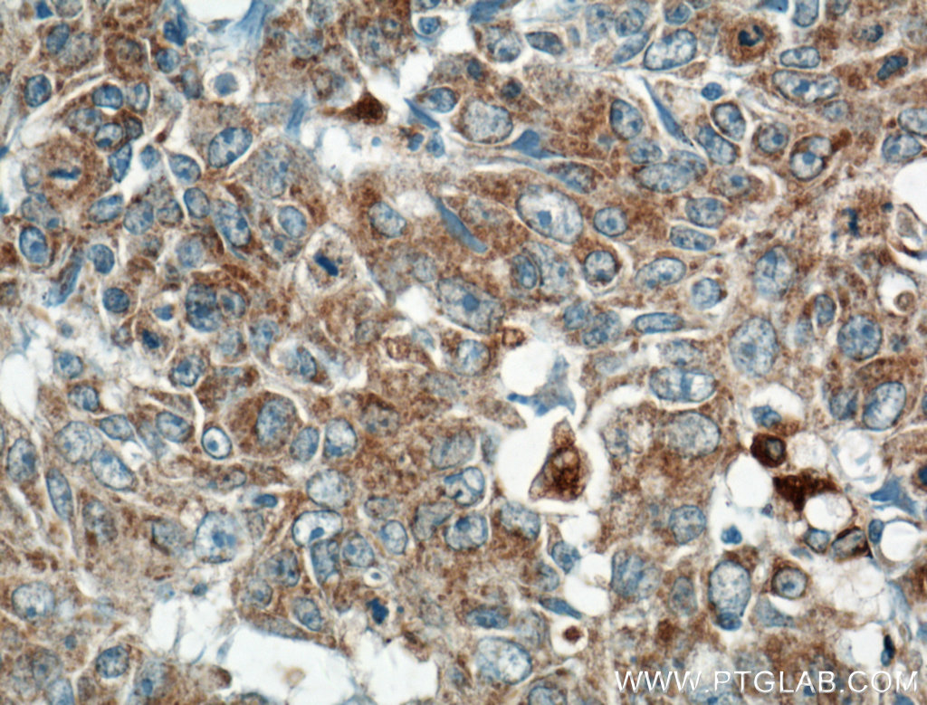 ARNTL Antibody 142681AP Proteintech