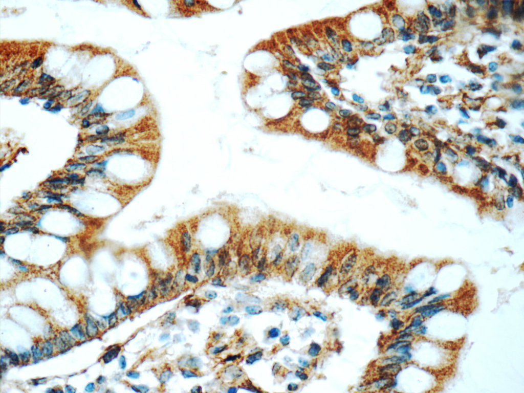 25616-1-AP;human small intestine tissue