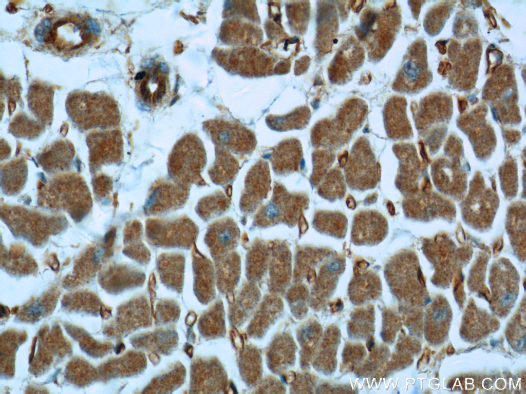 25616-1-AP;human heart tissue