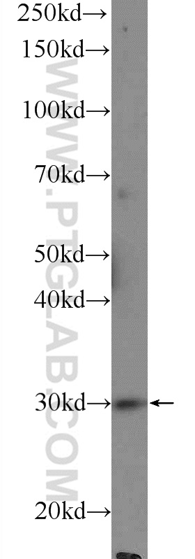 25616-1-AP;mouse heart tissue