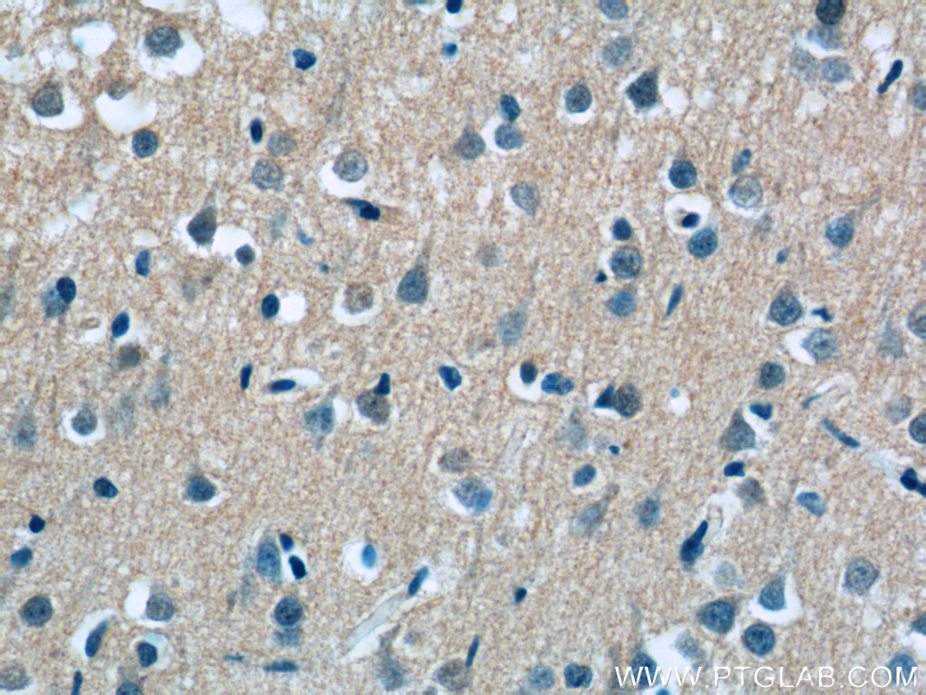 17351-1-AP;human brain tissue