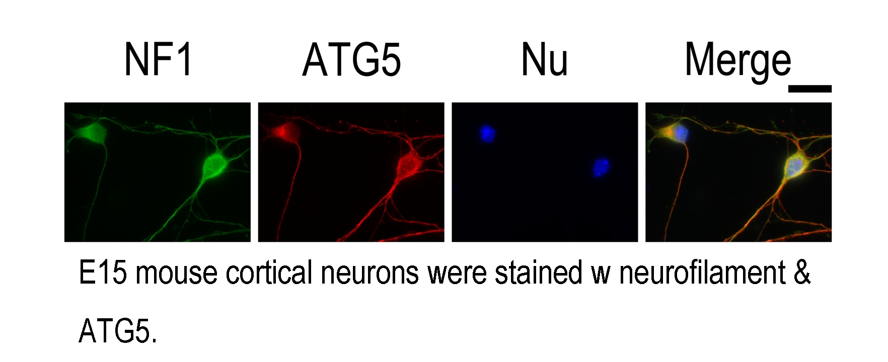 cortical plate,platemovement if result of anti-atg5 (10181-2-ap) with e15 mouse cortical