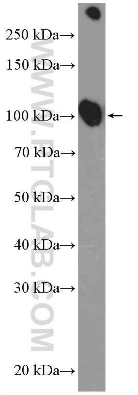 14418-1-AP;mouse heart tissue