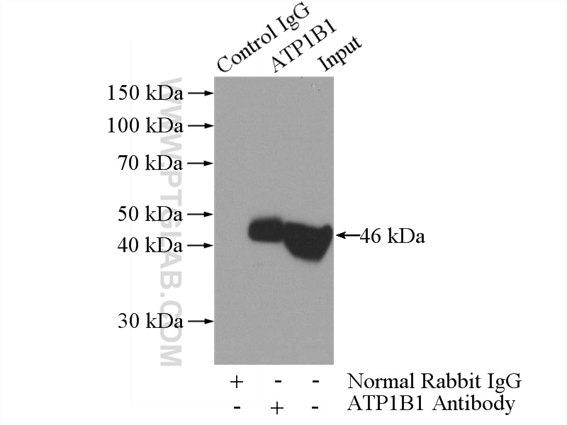 atp1b1-antibody-15192-1-ap-proteintech