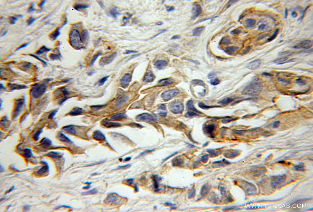 ATP1B3 Antibody 111421AP Proteintech