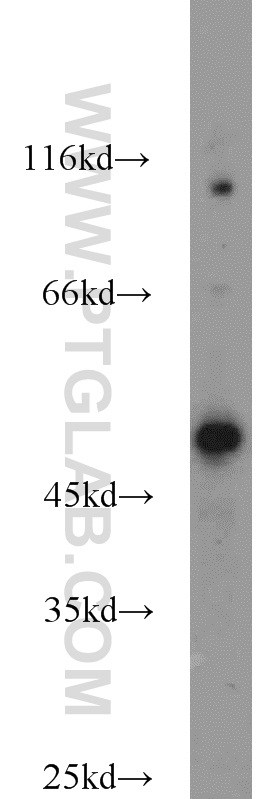 22879-1-AP;Jurkat cells