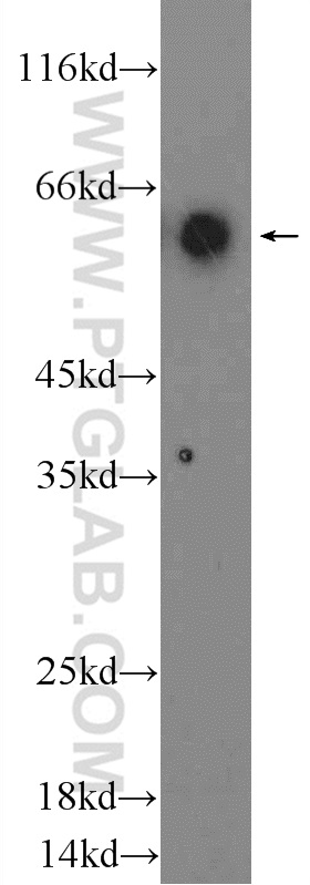 14292-1-AP;Human peripheral blood leukocyte cells