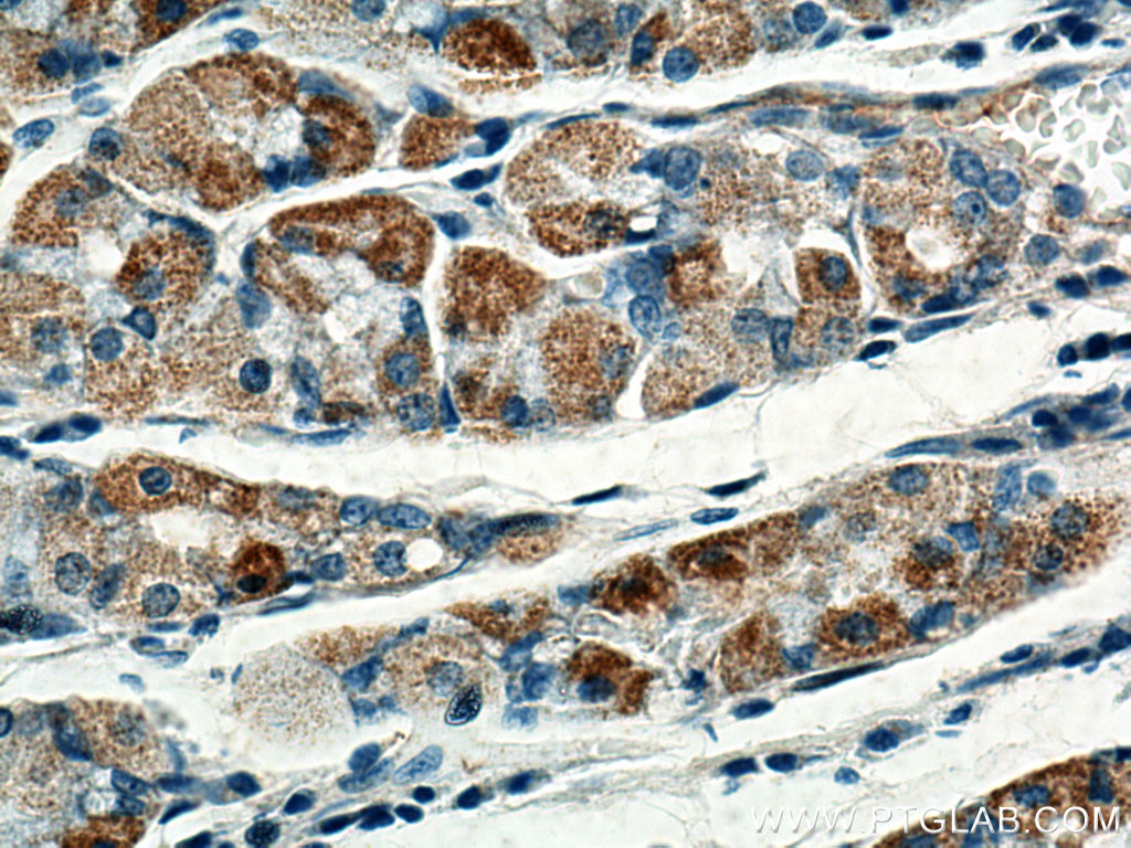 BCKDHB Antibody 136851AP Proteintech