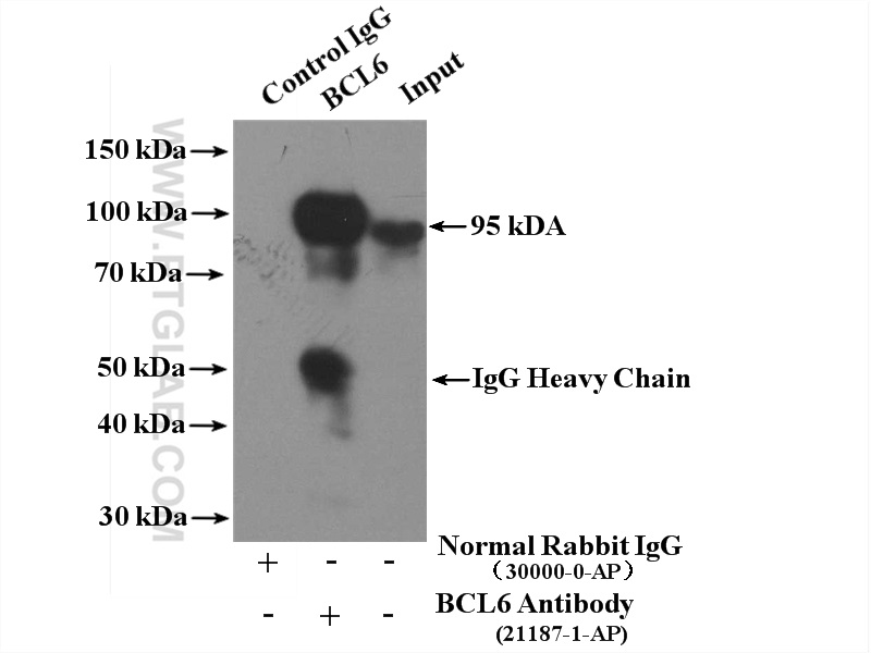 BCL6 Antibody 211871AP Proteintech