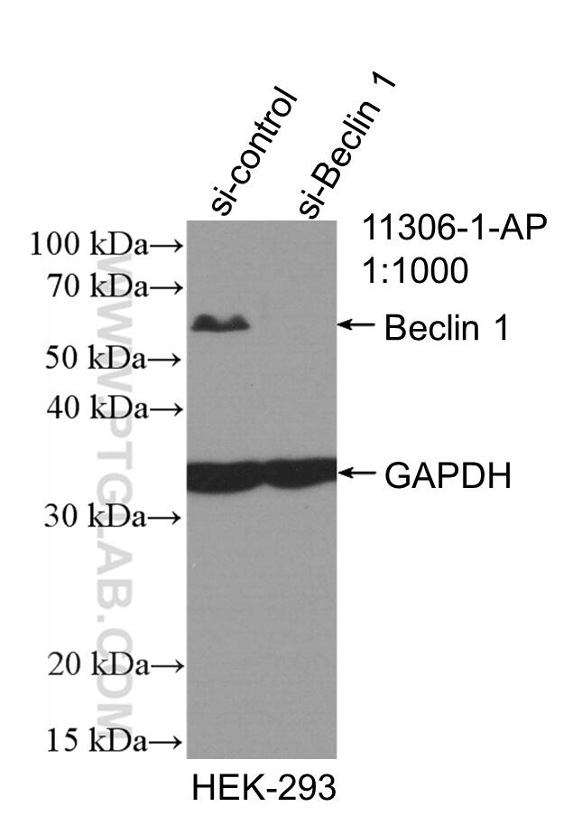 Beclin 1 Antibody 113061AP Proteintech