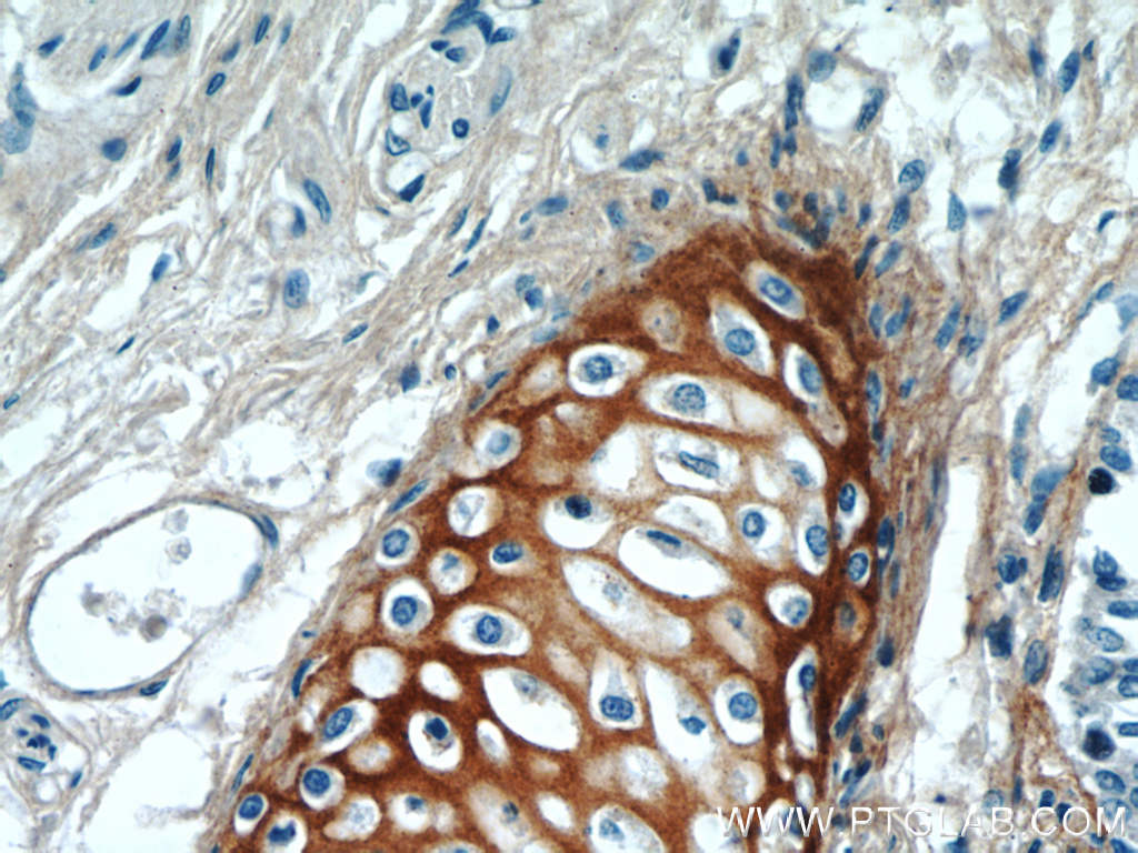 16409-1-AP;human lung tissue