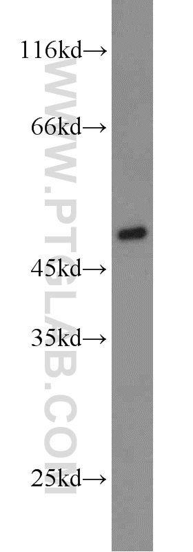 18982-1-AP;A2780 cells