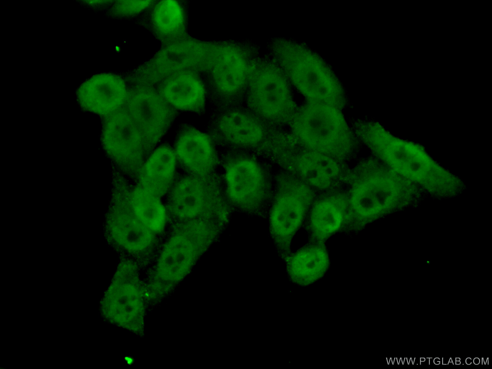 10476-1-AP;HeLa cells