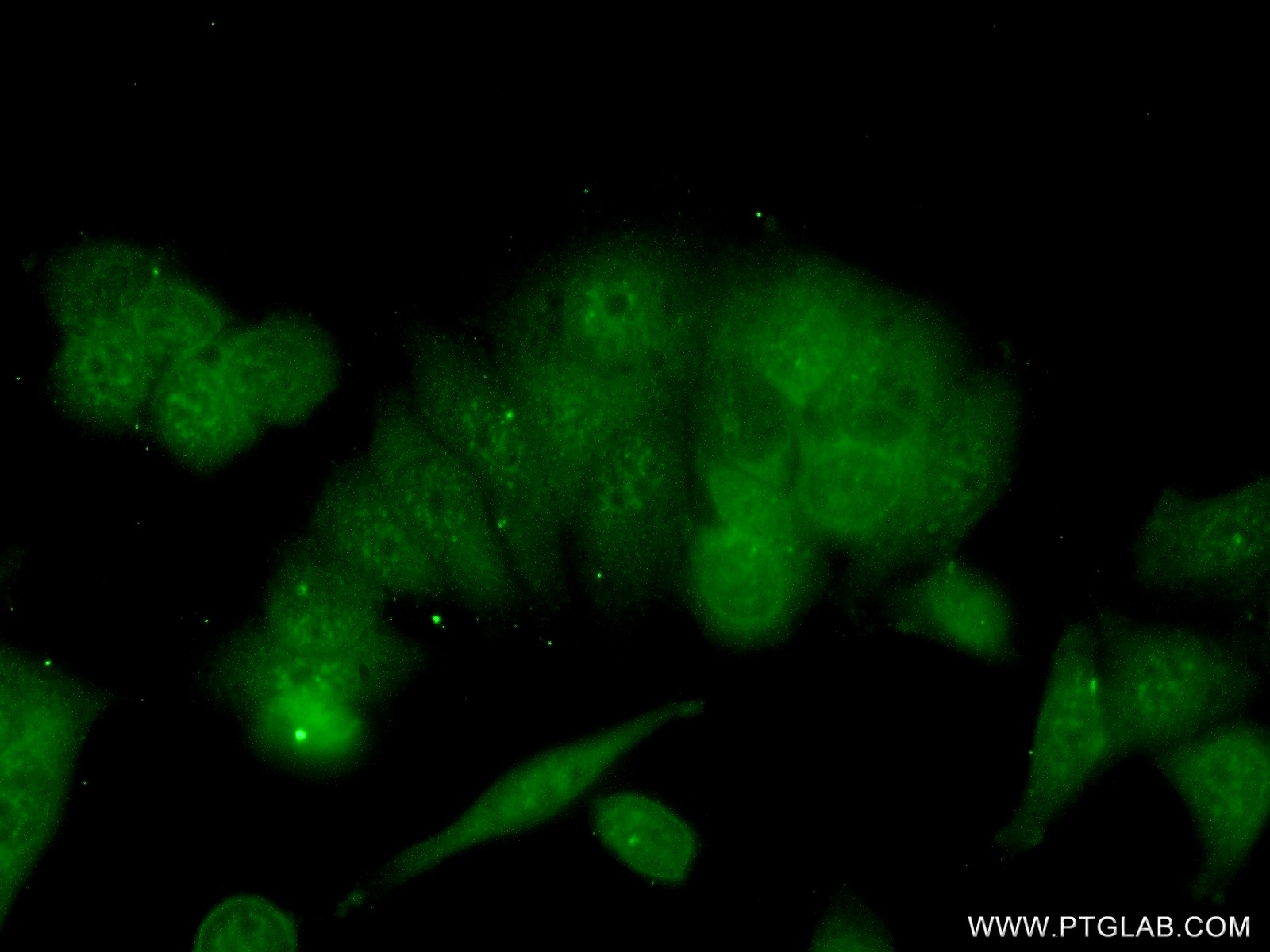 16096-1-AP;MCF-7 cells