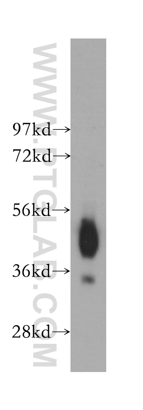 11989-1-AP;human liver tissue
